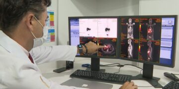Câncer de próstata tem novo tratamento com radioterapia reduzida
