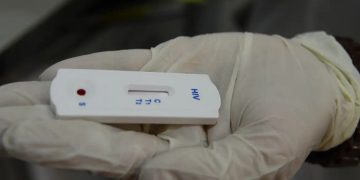 Farmácias autorizadas a realizar testes de ISTs devem ficar atentas à nota técnica do Ministério da Saúde Farmácias autorizadas a realizar testes de ISTs devem ficar atentas à nota técnica do Ministério da Saúde