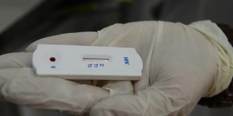 Farmácias autorizadas a realizar testes de ISTs devem ficar atentas à nota técnica do Ministério da Saúde Farmácias autorizadas a realizar testes de ISTs devem ficar atentas à nota técnica do Ministério da Saúde