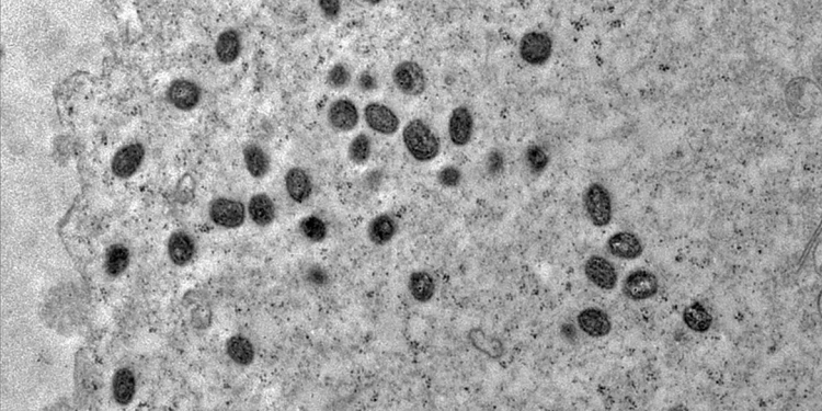 Brasil em atenção contra Mpox: 2024 já supera 2023 no número de casos