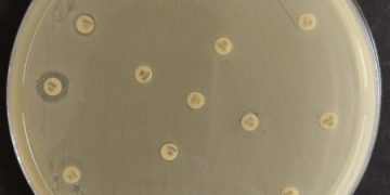 Risco global: bactéria multirresistente é encontrada em paciente brasileira Risco global: bactéria multirresistente é encontrada em paciente brasileira