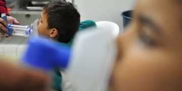 InfoGripe: Influenza A é a principal causa de mortes por SRAG em 2025 InfoGripe: Influenza A é a principal causa de mortes por SRAG em 2025