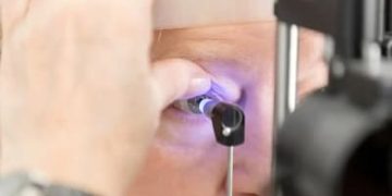 Transplante de córnea: 33 mil pessoas aguardam cirurgia no Brasil