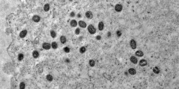 Mpox: São Paulo confirma segundo caso da doença pela nova cepa clado Ib Mpox: São Paulo confirma segundo caso da doença pela nova cepa clado Ib