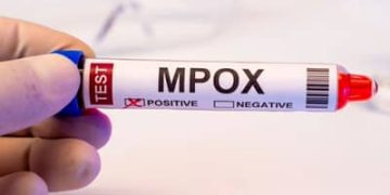 Mpox: Brasil registra 88 casos em seis estados e no DF em 2026; saiba mais sobre a doença Mpox: Brasil registra 88 casos em seis estados e no DF em 2026; saiba mais sobre a doença
