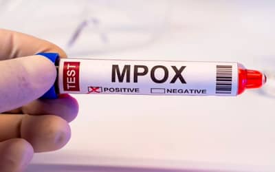 Mpox: Brasil registra 88 casos em seis estados e no DF em 2026; saiba mais sobre a doença Mpox: Brasil registra 88 casos em seis estados e no DF em 2026; saiba mais sobre a doença