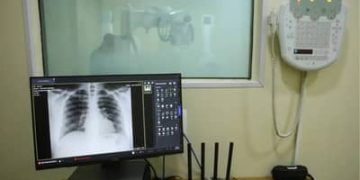 RS decreta emergência em saúde pública diante da alta de hospitalizações  por doenças respiratórias
